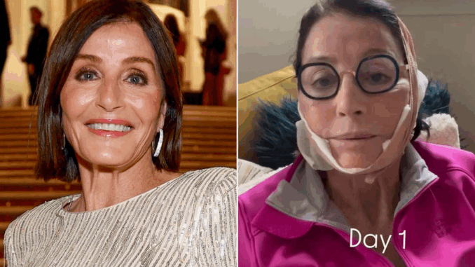 kathy-swarts-facelift-instagram Kathy Swarts